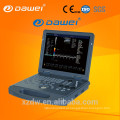 China fabricante CE ISO Laptop médico portátil ultra-som doppler colorido